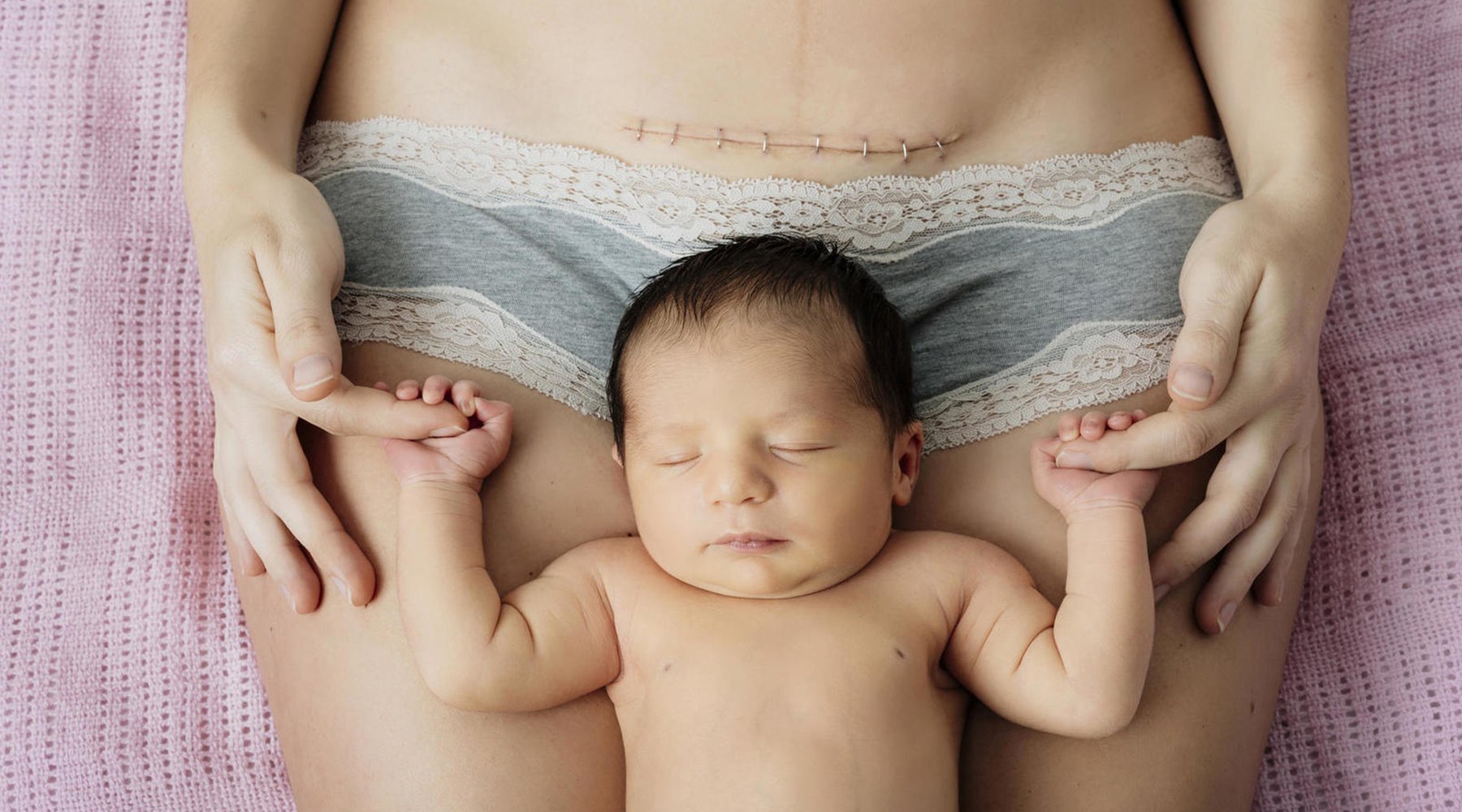 9 Myths about C-Section - Lovemere